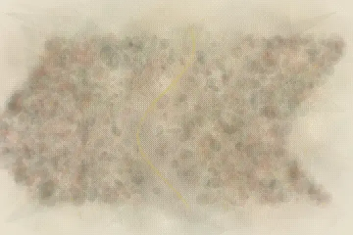 Quiet Wound Assembly: cumulative painting state 3 of 3; An asymmetric living field stages cells gather at the quiet wound. through pressure, granular deposits, abrasion, and exposed support.